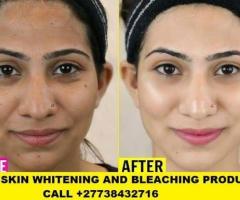 Skin Lightening Skin Whitening Products +27738432716